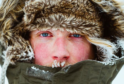 Холодовая аллергия. Что делать?